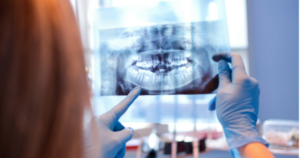A dentist holding up a dental xray - Are dental xrays safe?